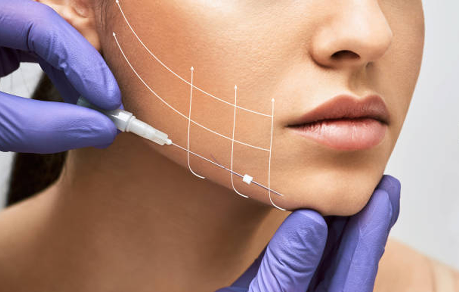 Face Lifting